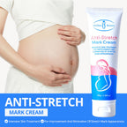 Aichun Beauty Anti-Stretch Mark Cream 100g – Pregnancy পেটের Stretch Mark Care Cream