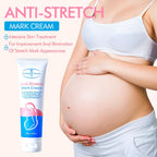 Aichun Beauty Anti-Stretch Mark Cream 100g – Pregnancy পেটের Stretch Mark Care Cream